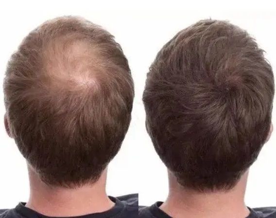 Загусник для волосся Toppik Hair Building Fibers (Gray) Сірий Toppik Gray фото