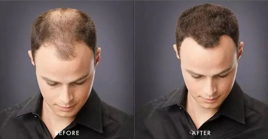 Загусник для волосся Toppik Hair Building Fibers (Gray) Сірий Toppik Gray фото
