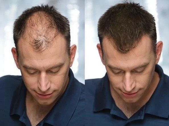 Загусник для волосся Toppik Hair Building Fibers (Medium Brown) Середньо-коричневий 1691912325 фото