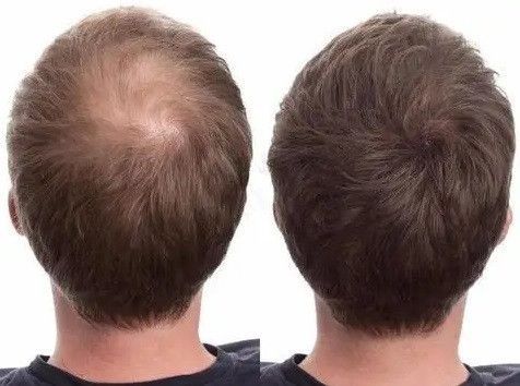 Загущувач для волосся Toppik Hair Building Fibers (Light Brown) Світло-коричневий 1711471317 фото